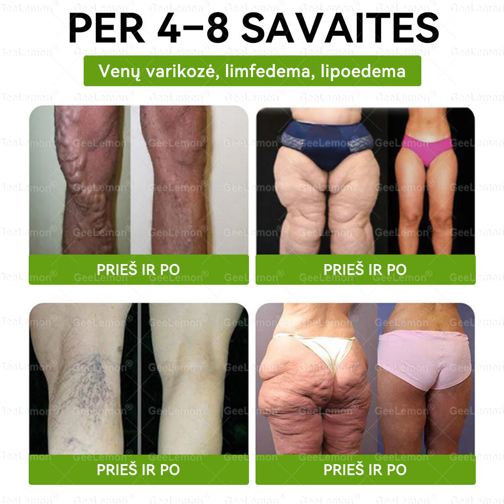 🎁 Liko tik 5 dėžutės! Dabar suteikiame papildomą 50 % nuolaidą! Būkite žvalūs ir sveiki. Jei nepasinaudosite proga dabar, kita galimybė bus tik kitais metais!